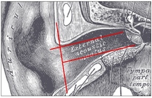 Figure 4. Ear canal length, showing that the superior portion of the TM is closest to the external environment. Both red lines from the aperture to the TM are the same length. 