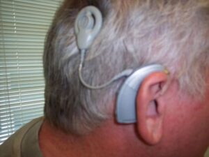 cochlear-implant-small