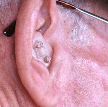 eardrum hearing aid fitting influence