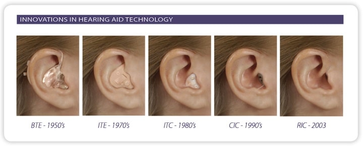Major innovative cosmetic changes in hearing aids since the 1950s that dominated the marketplace.  The BTE (behind-the-ear) hearing aid of the 1950s is shown with a full shell earmold.  In the 1970s, the ITE (in-the-ear) began its steady climb to drive the market.  Smaller hearing aid components led to less visible (more cosmetic) hearing aids during the 1980s with the ITC (in-the-canal) hearing aid being a featured configuration.  This was replaced in the 1990s with the CIC (completely-in-the-canal) unit, again benefiting from instrument component size reductions.  The RIC (receiver-in-the-canal) of the 2000s and continuing today benefited from component size reduction, but also allowed a larger processor (behind the ear) to allow for electronic and acoustic benefits. 