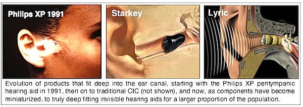 Invisible hearing aids
