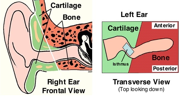 Figure 4. Cartilaginous versus osseous (bony) sections of the external auditory meatus 