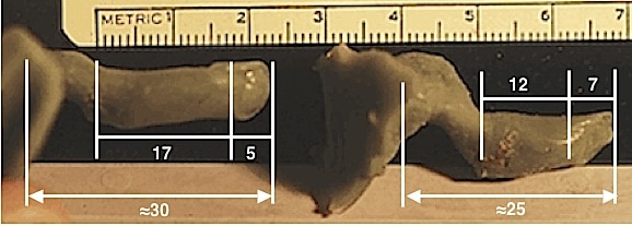 Figure 13.  Ear impressions of the complete external auditory canal, including imprints of the tympanic membrane, taken from live subjects.  The tympanic membrane contributes approximately 6 mm to the overall length of the ear canal, and as a result, affects the measurement length, depending on the contact area to where the measurement is made.  If the measurement is made along a superior-posterior axis, the length will be shorter than if the measurement is made along an inferior-anterior axis.  This fact contributes to variations in ear canal length measurements.  (Wayne Staab photos).