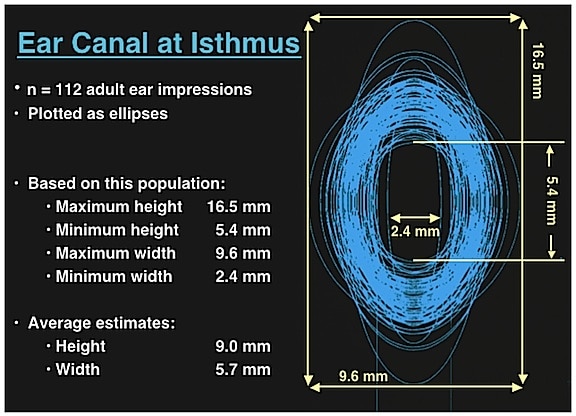 Figure 6. Range of vertical and horizontal measurements of the isthmus taken from 112 impressions made on live subjects. (Staab & Sjursen, 2000).