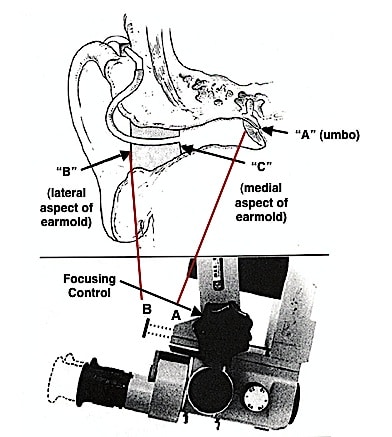 Figure 16. Ear canal length determination using a microscope two-point focal procedure used by Zemplenyi, Gilman, and Dirks, 1985. This method is limited to measurements of length only.