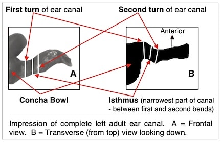 Figure 9. Two views of the human ear canal. That on the left (A) is that most commonly shown. However, the view from above looking down provides the best information relative to the shape of the ear canal. 