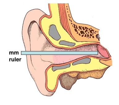 Figure 14. Direct physical measurement of the ear canal length using a measurement gauge inserted into the ear canal until it contacts the tympanic membrane.