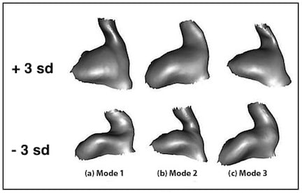 Figure 4.  Size and shape model.  The top three modes of variation are shown at +3 and the bottom three modes at –3 standard deviations from the mean shape.
