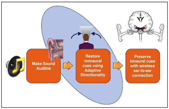 Figure 1. Evolution of speech intelligibility in hearing aids. The industry has developed beyond the first goal, that of making sound audible, and continues to improve upon and expand goals two and three.