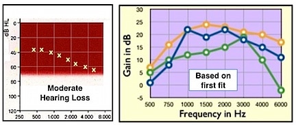 Figure 1. Moderate sloping hearing loss (left) to which three premium RIC open fit hearing aids were programmed. The frequency responses on the right are the 2cc coupler responses for the quick fit as prescribed by the manufacturers’ fitting software.