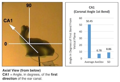 Figure 3. Axial view of the measurement method used to determine the angle of the first bend of the ear canal. Measurement was made from a line drawn through the center of the first bend from the concha. (n=56) 