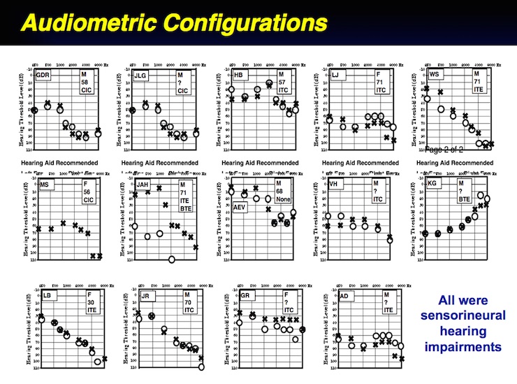 Figure 2. Audiometric configurations of he fourteen (14) subjects used in this study. 