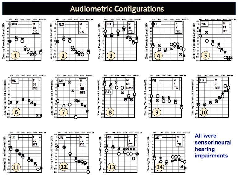 Figure 1. Pure-tone air-conduction thresholds for the fourteen subjects. All subjects were evaluated as having sensorineural hearing, and therefore, no bone-conduction thresholds are shown.