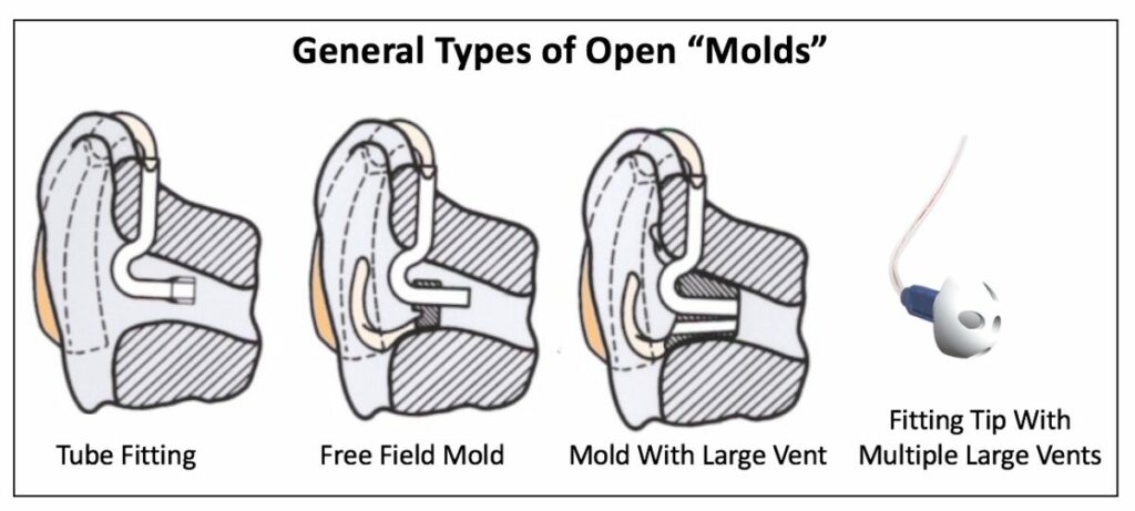 Open Earmold Hearing Aid Fittings A Brief History Hearing Health