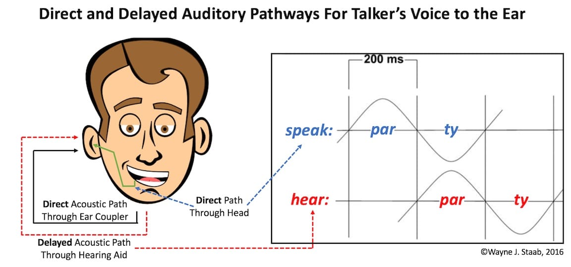 Figure 2. Illustration showing direct acoustic pathways for a talker’s voice through the air, and through the head (solid black and green lines), along with the delayed pathway through a DSP hearing aid to the ear (dashed line). On the right is shown delay causing maximum auditory confusion at 200 msec. delay.