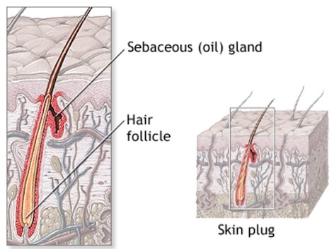 Earwax: Sweat and Cerumen Glands | Hearing Health & Technology Matters