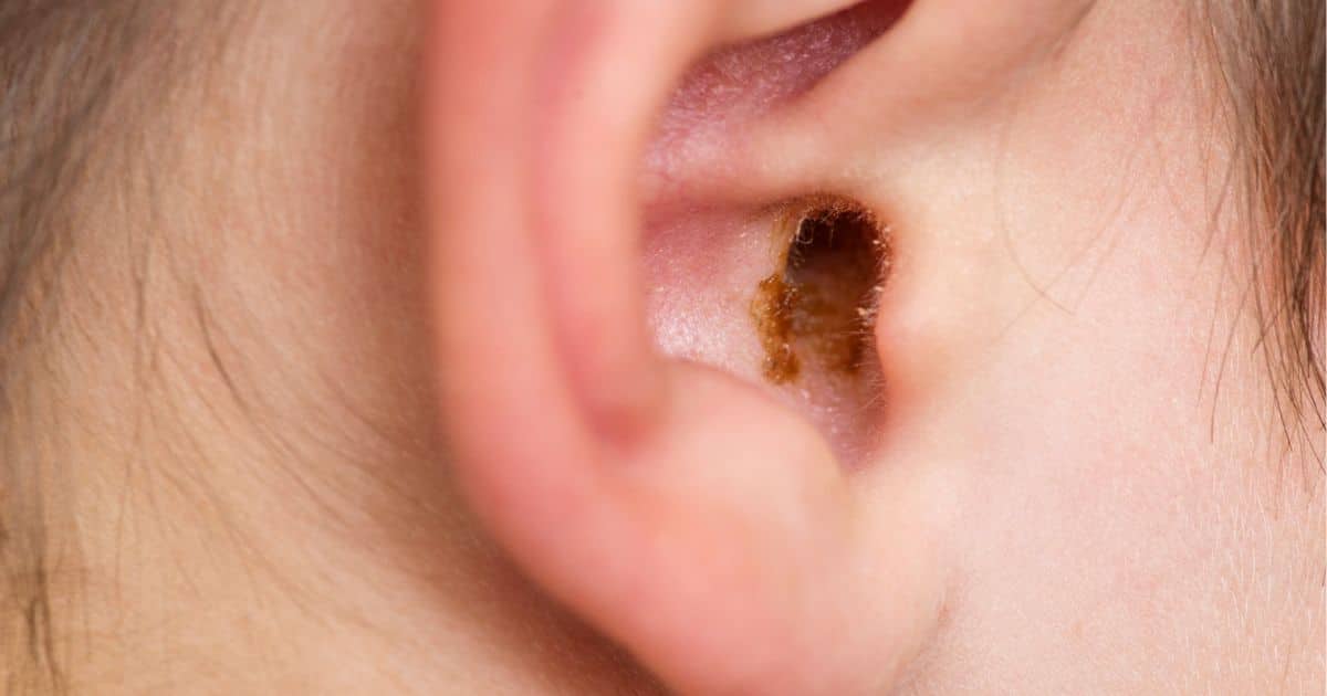 earwax and glands in ear