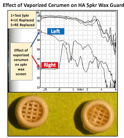 Figure 3. The impact of vaporized cerumen on a mesh-type hearing aid speaker wax screen (left). Both the left and right hearing aids were essentially non-functional as indicated by their respective response curves. Following wax guard replacement, both (curves 4 and 5 at the top) measured the same as a test speaker (curve 1 at the top).