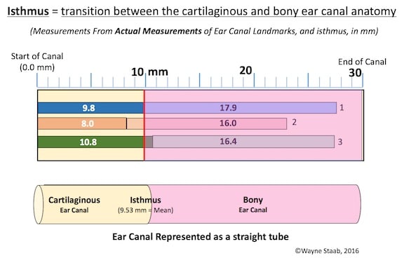 Figure 2. Location of the isthmus, based on actual measurements. The isthmus is described as being between the first and second bends of the ear canal, and is often the narrowest part of the ear canal.