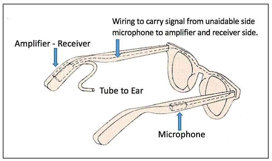 Figure 1. CROS concept, where CROS stands for Contralateral Routing of Signals. In the eyeglass example shown, the microphone, placed on the unaidable ear side (of a unilateral hearing loss), picks up the signal on that side, and via wires, carries the signal to the opposite/contralateral ear that has normal or near normal hearing. The signal is amplified and sent by the hearing aid receiver/speaker to the good ear, delivered via an open tube to allow normal sounds to be heard by the normal ear as well.