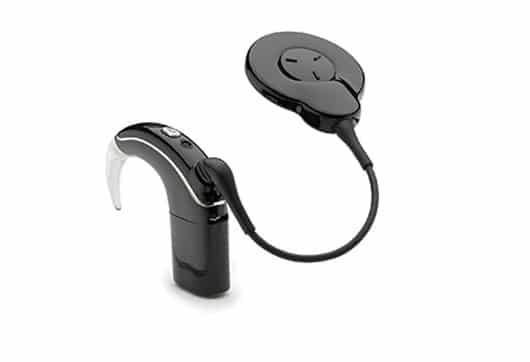 cochlear implant made for iphone