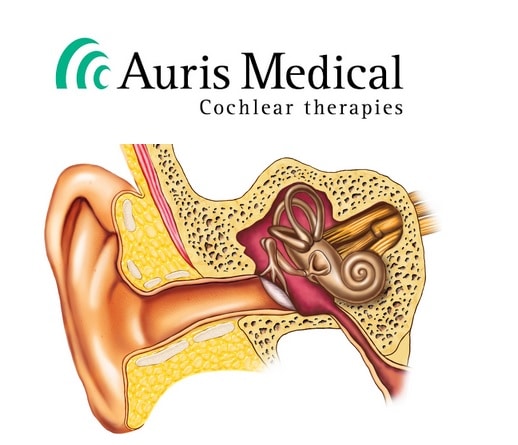 auris medical hearing loss drug failure