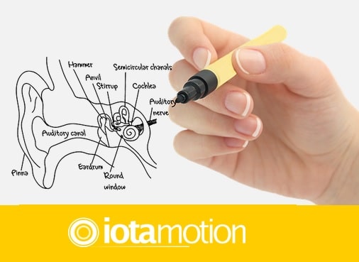iotamotion cochlear implant robot surgery