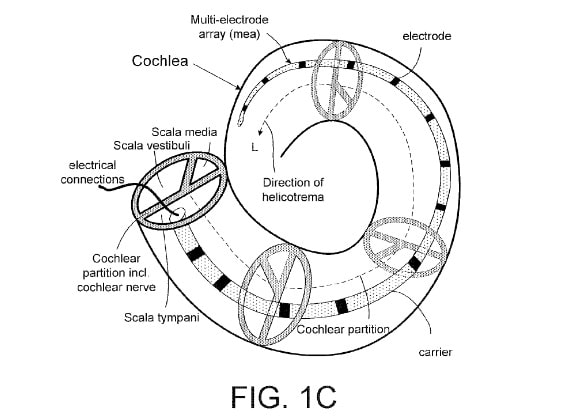oticon medical cochlear implant patent