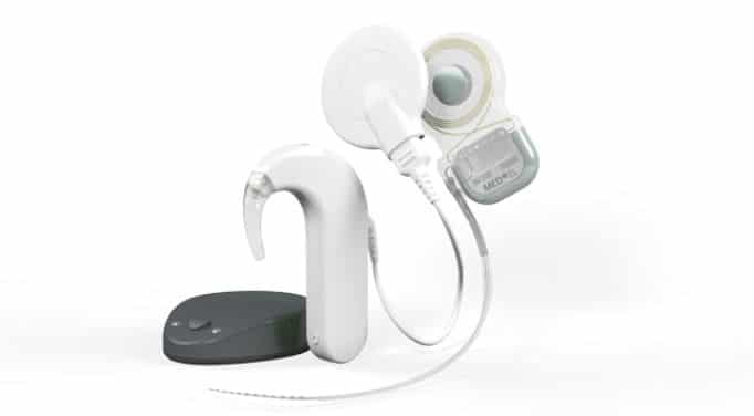 cochlear implant single sided deafness med-el