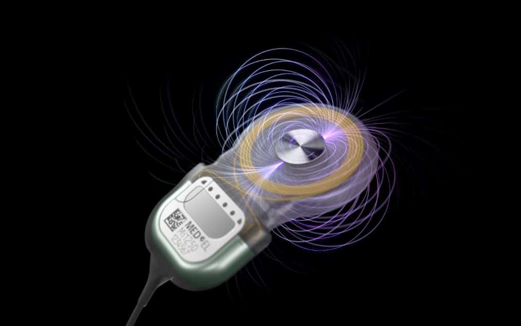 Featured image for “MED-EL USA Releases New S-Vector Magnet for SYNCHRONY 2 Cochlear Implants”
