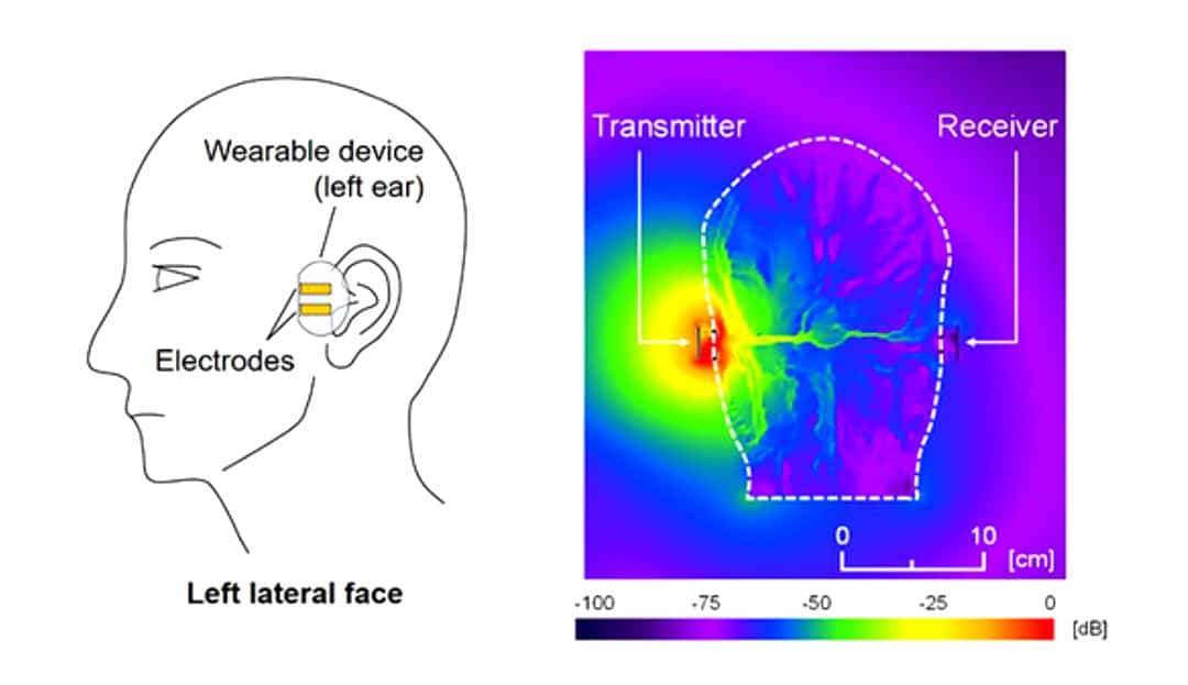 Featured image for “Scientists Explore Human-Body Communications with Binaural Hearing Aids”