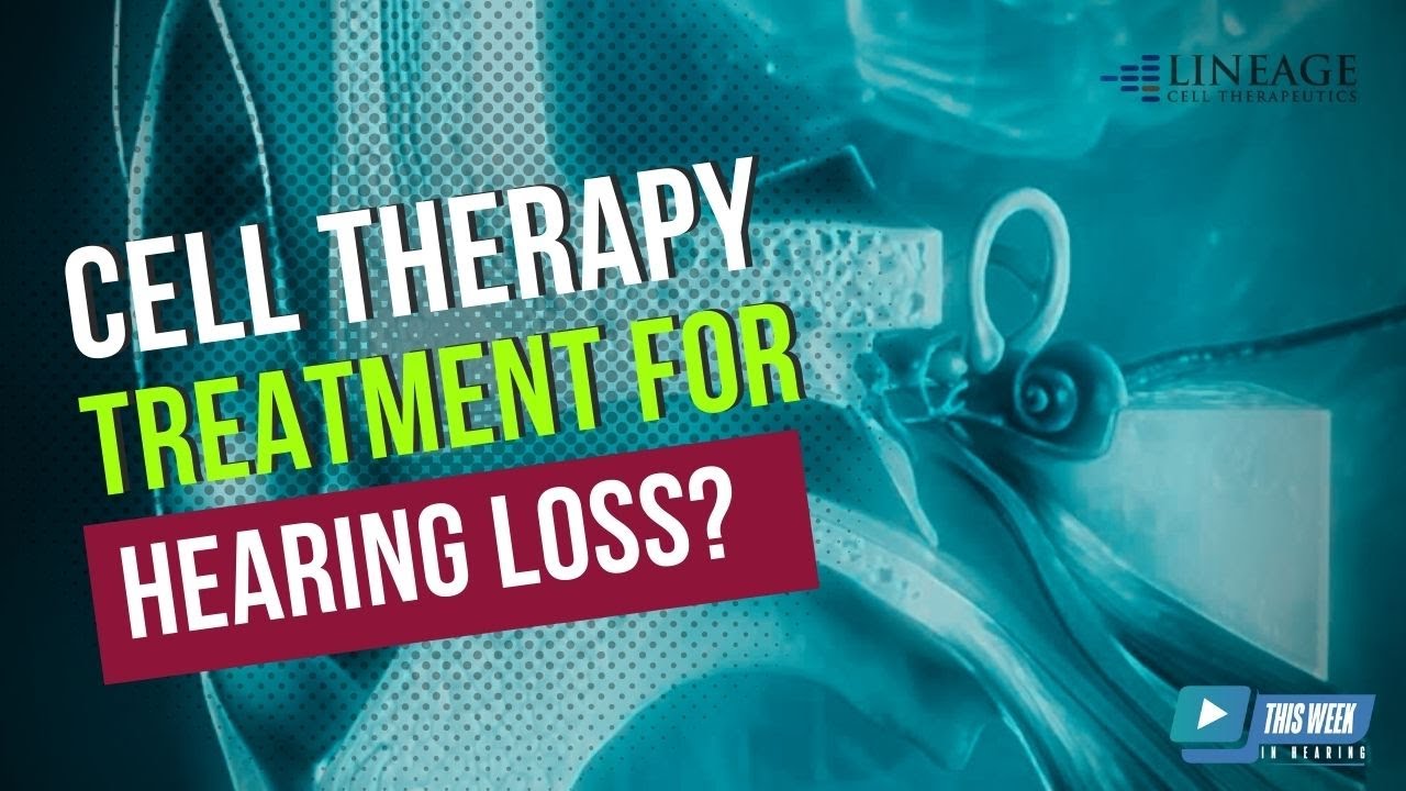 cell therapy for hearing loss