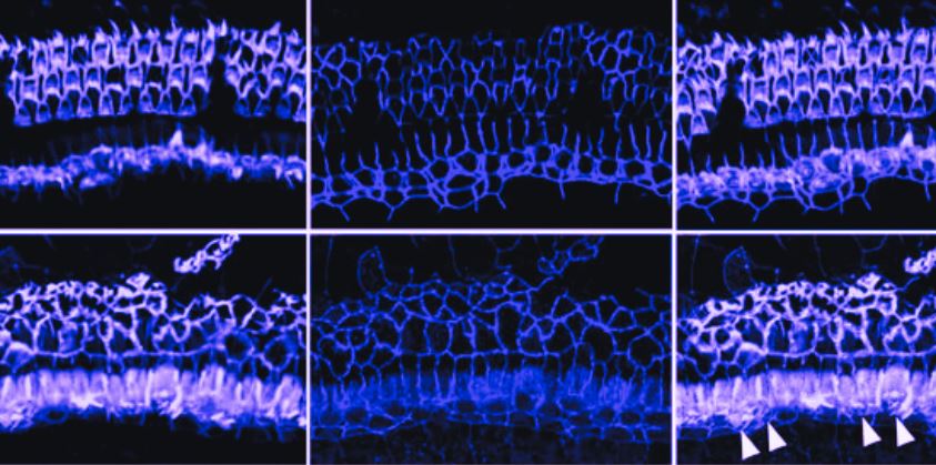 Featured image for “Researchers Find Checkerboard-Like Arrangement of Cells in Inner Ear Vital for Hearing”