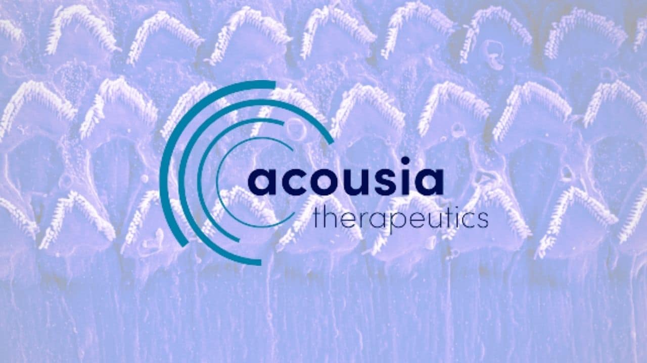 acousia therapeutics hearing loss treatment