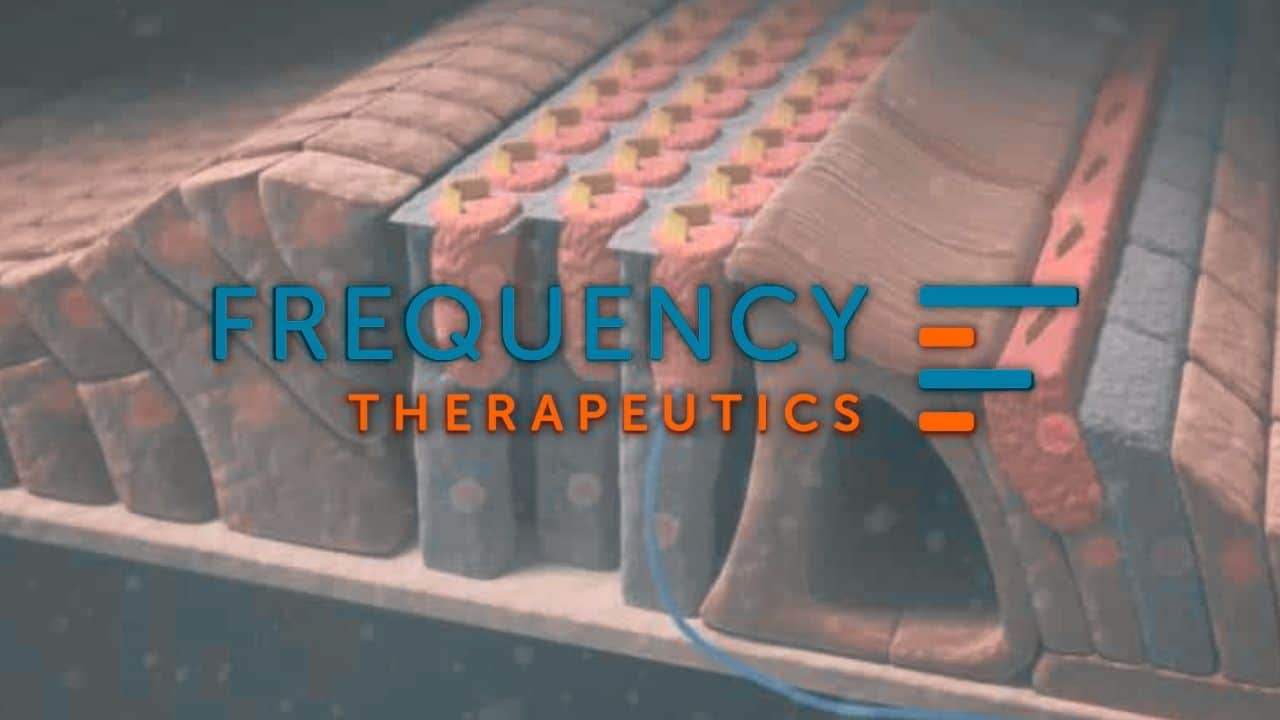 frequency therapeutics fx 345