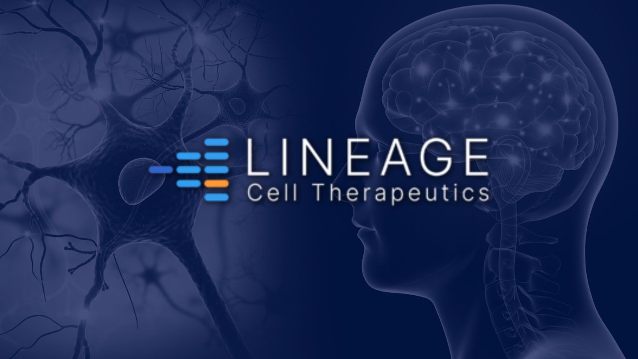 lineage cell therapeutics hearing loss treatment