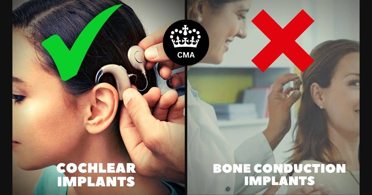 cochlear oticon medical acquisition cma