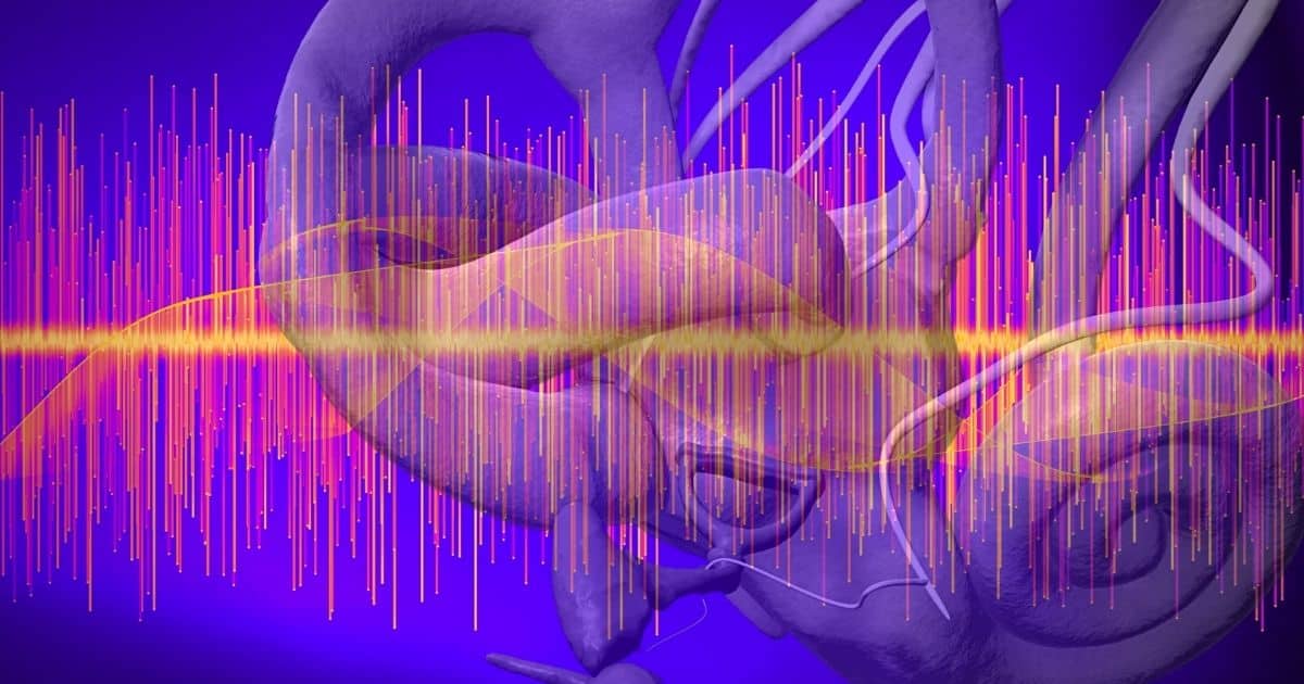 cochlear signal noise induced hearing loss