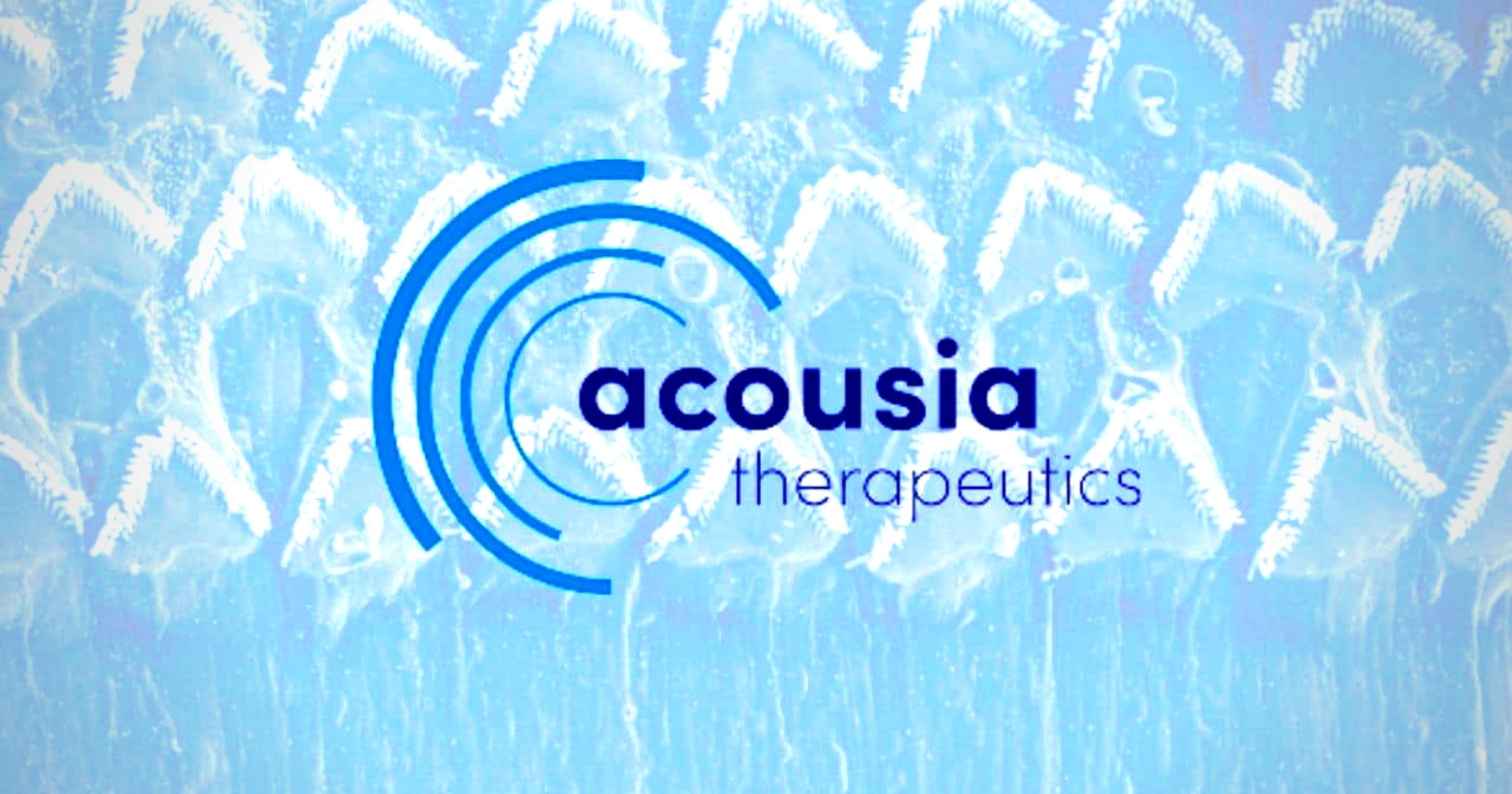 acousia therapeutics hearing loss treatment chemotherapy
