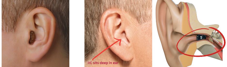 cic vs iic hearing aid size
