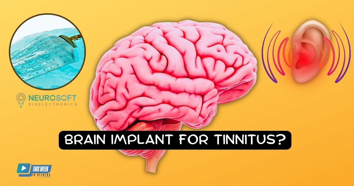 Featured image for “Could Severe Tinnitus be Treated with a Brain Implant? New Technology Under Development Holds Promise”