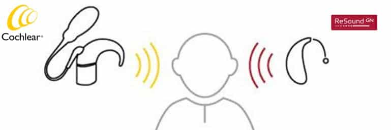 resound cochlear bimodal wireless connectivity