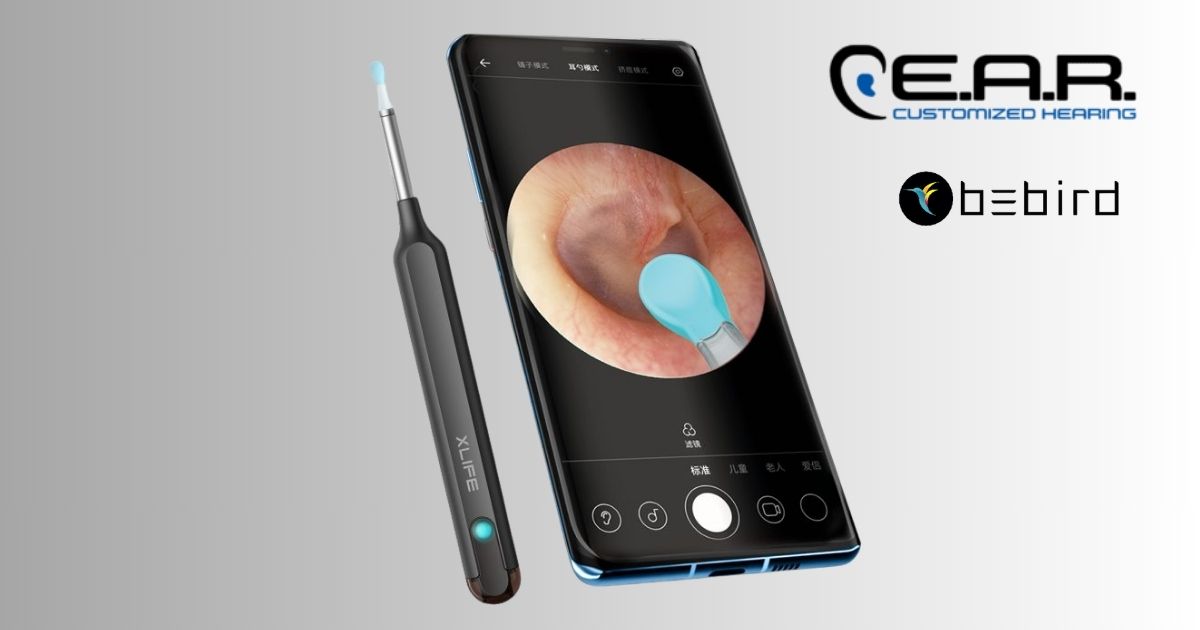 Featured image for “New Video Otoscope Tools Aim to Improve Ear Exams and Wax Removal”