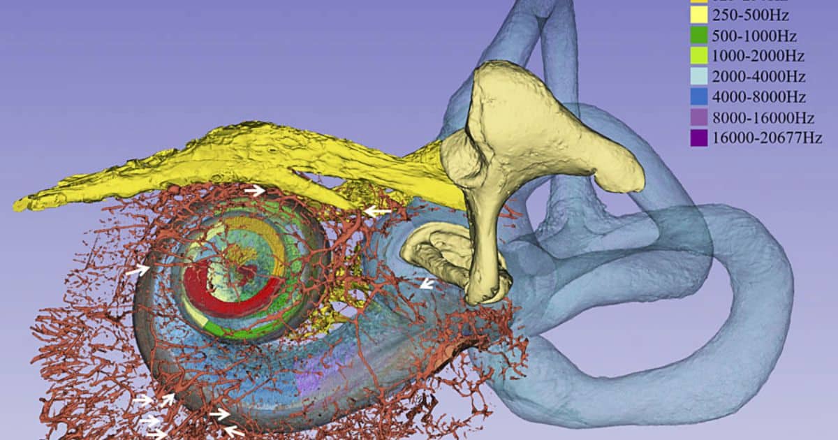 Featured image for “Advanced Synchrotron Imaging Unveils New Insights into Otosclerosis”