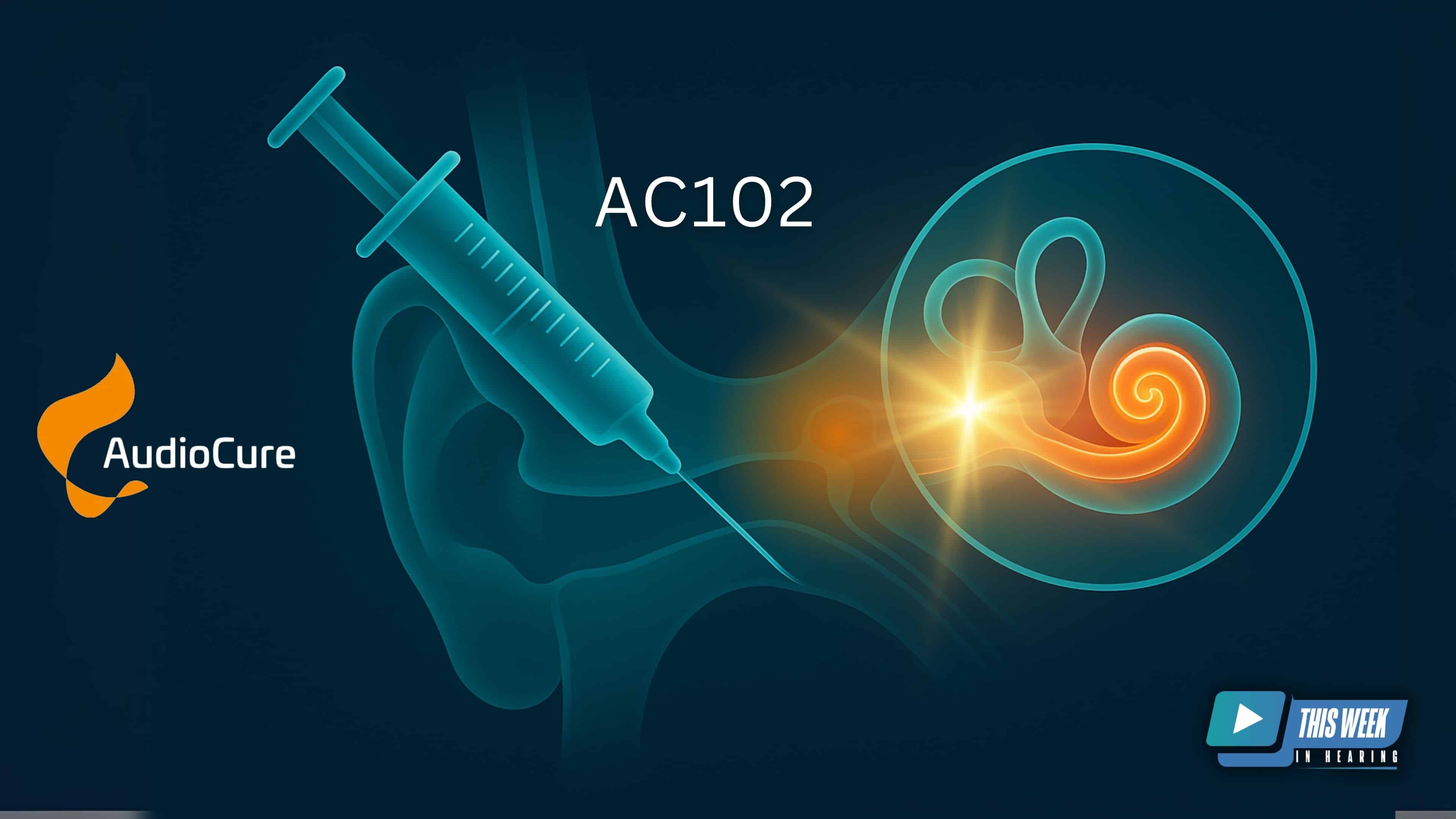 ac102 hearing loss tinnitus treatment
